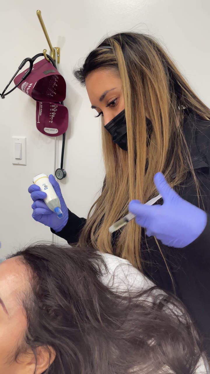 Microneedling treatment at Pure Radiance — clip 3