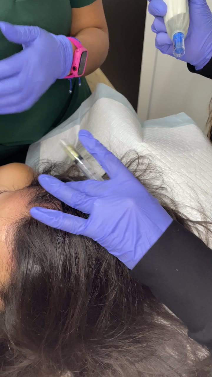 Microneedling treatment at Pure Radiance — clip 4