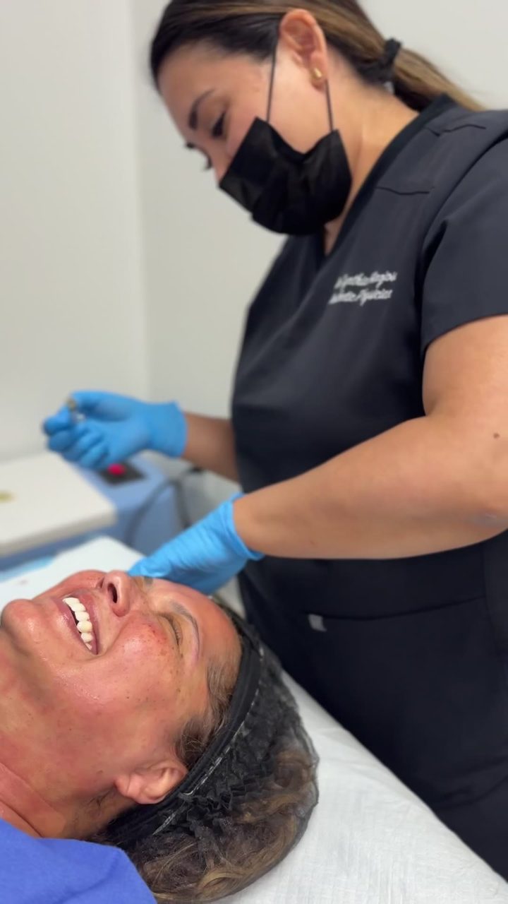 Microneedling treatment at Pure Radiance — clip 10