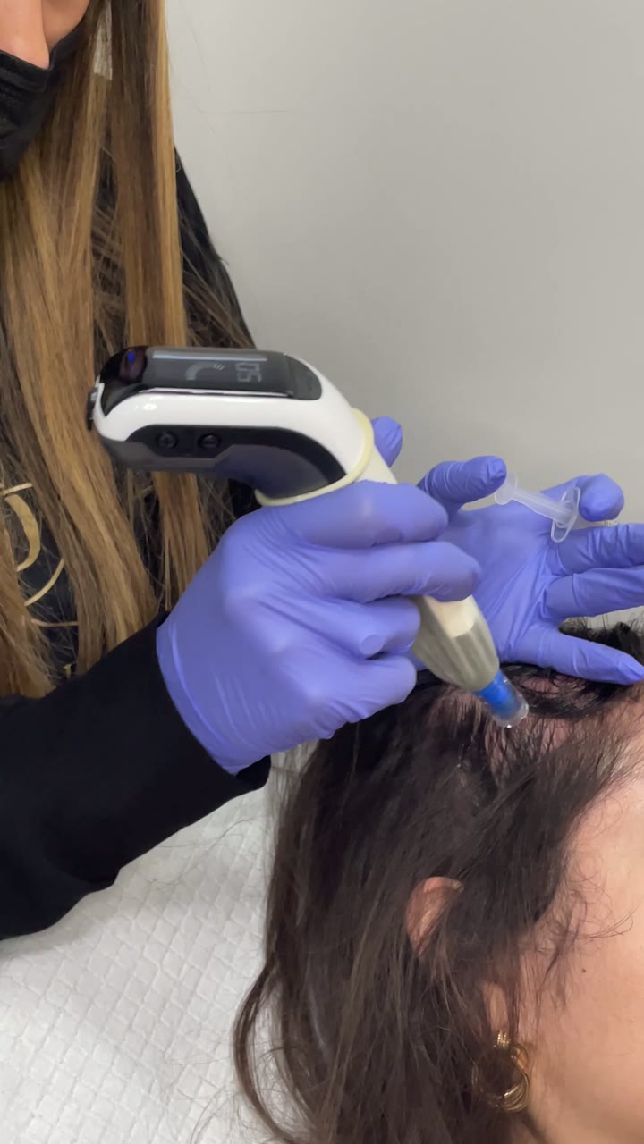 Microneedling treatment at Pure Radiance — clip 5