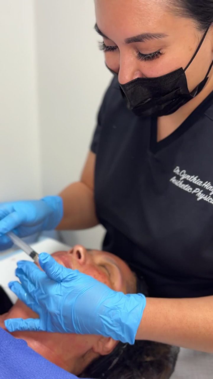 Microneedling treatment at Pure Radiance — clip 9